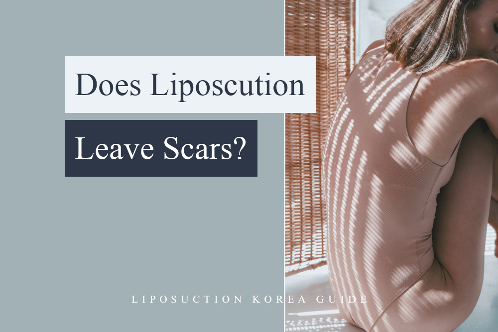 does liposuction leave scars