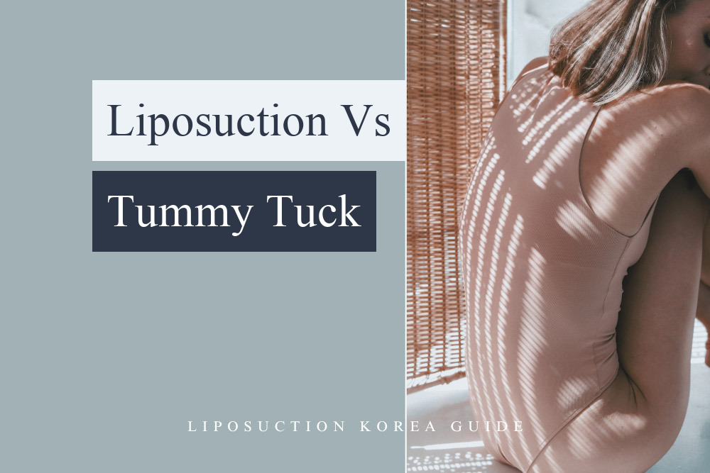 liposuction vs tummy tuck